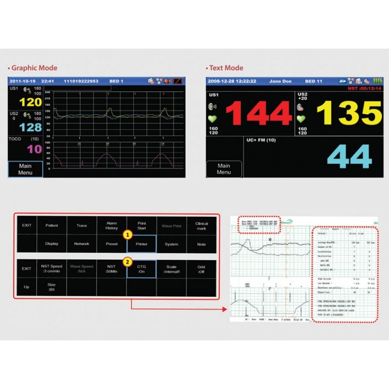 MONITOR FETALE FC1400 GEMELLARE CON STAMPANTE - Monitor multiparametrici
