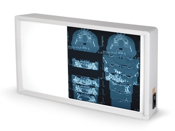 NEGATIVOSCOPIO 38x62 cm - Altre apparecchiature diagnostiche - Immagine 2