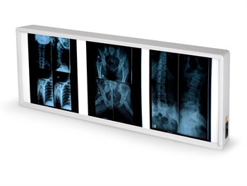 NEGATIVOSCOPIO DOPPIO 38 x 92 cm - Altre apparecchiature diagnostiche - Immagine 2
