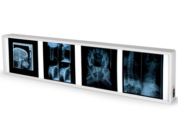 NEGATIVOSCOPIO QUADRUPLO 38 x 153 cm - Altre apparecchiature diagnostiche - Immagine 2