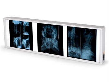 NEGATIVOSCOPIO TRIPLO 38 x 122 cm - Altre apparecchiature diagnostiche - Immagine 2