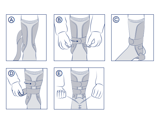 Ligacast Anatomic - Immagine 2